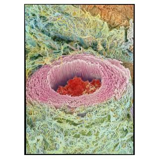 Coloured SEM of section through a human arteriole