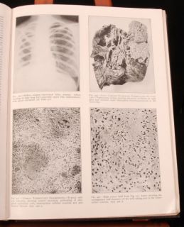 1948 Essentials Pathology Smith Gault Illus Medical
