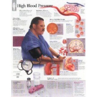 High Blood Pressure Chart Wall Chart Scientific
