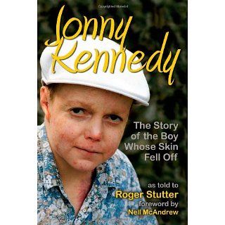 Jonny Kennedy The Story of the Boy Whose Skin Fell Off 
